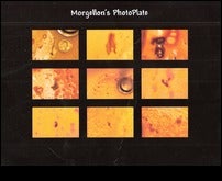 MorgellonsPhotoplate.jpg